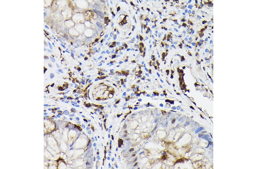 Immunohistochemistry - Anti-Gelsolin Antibody (A93230) - Antibodies.com