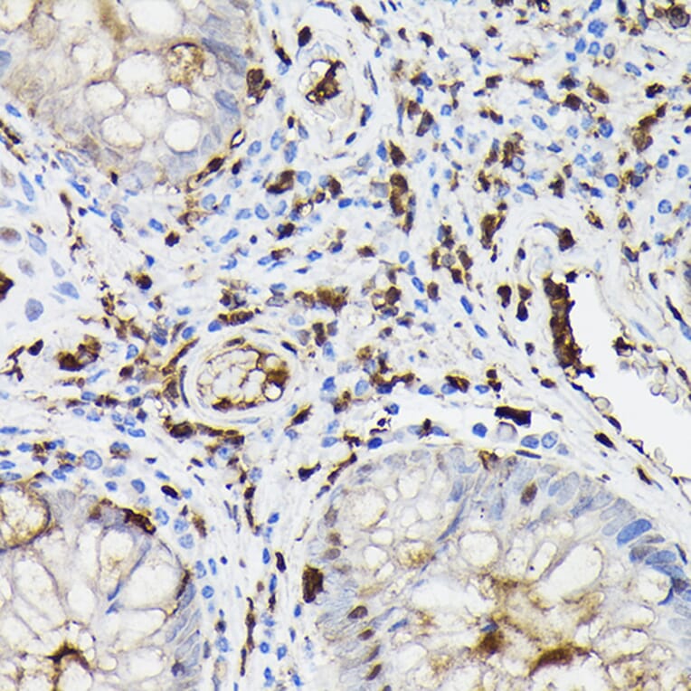 Immunohistochemistry - Anti-Gelsolin Antibody (A93230) - Antibodies.com