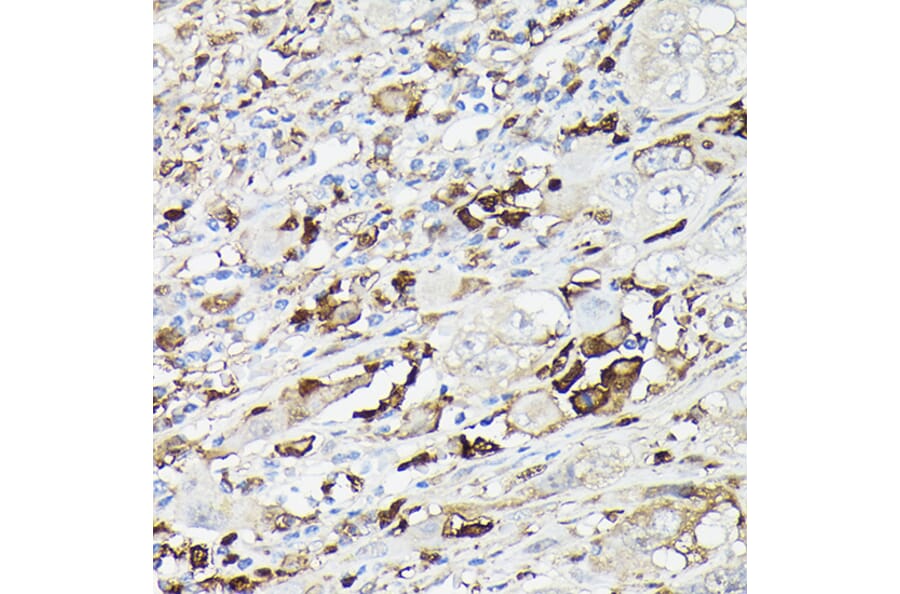 Immunohistochemistry - Anti-Gelsolin Antibody (A93230) - Antibodies.com