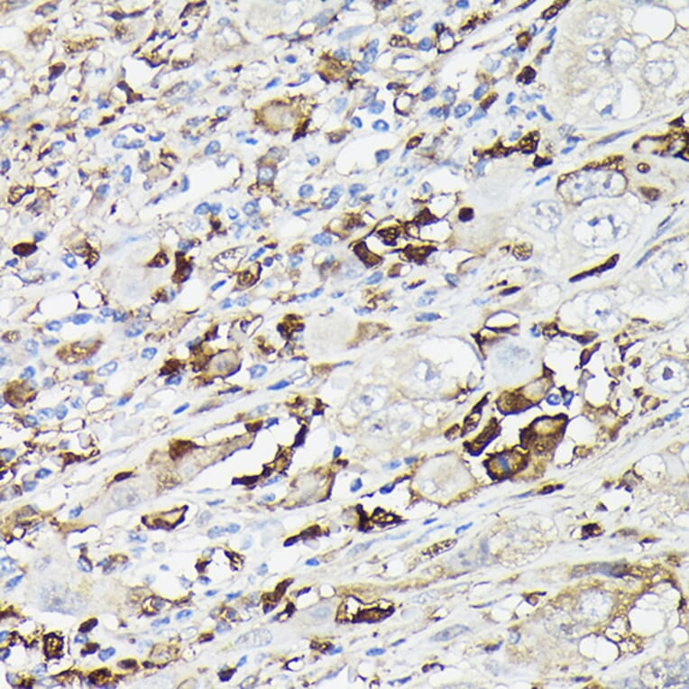 Immunohistochemistry - Anti-Gelsolin Antibody (A93230) - Antibodies.com