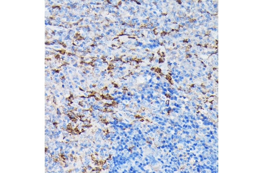 Immunohistochemistry - Anti-Gelsolin Antibody (A93230) - Antibodies.com