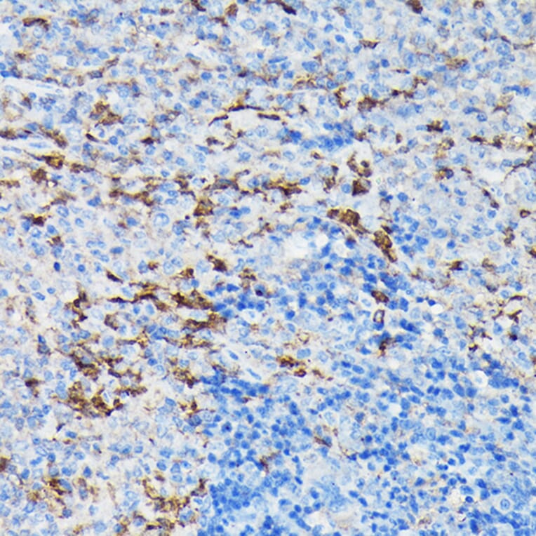 Immunohistochemistry - Anti-Gelsolin Antibody (A93230) - Antibodies.com