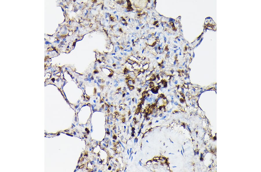 Immunohistochemistry - Anti-Gelsolin Antibody (A93230) - Antibodies.com
