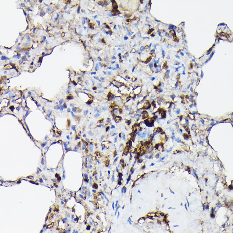 Immunohistochemistry - Anti-Gelsolin Antibody (A93230) - Antibodies.com