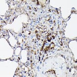 Immunohistochemistry - Anti-Gelsolin Antibody (A93230) - Antibodies.com