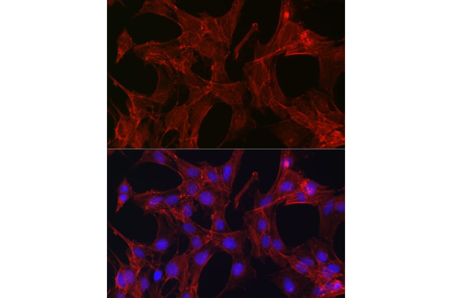 Immunofluorescence - Anti-Gelsolin Antibody (A93230) - Antibodies.com