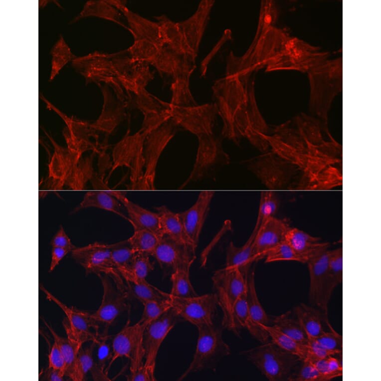Immunofluorescence - Anti-Gelsolin Antibody (A93230) - Antibodies.com