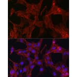 Immunofluorescence - Anti-Gelsolin Antibody (A93230) - Antibodies.com