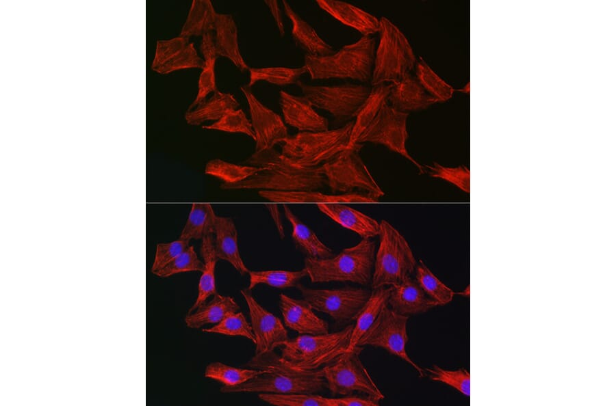 Immunofluorescence - Anti-Gelsolin Antibody (A93230) - Antibodies.com