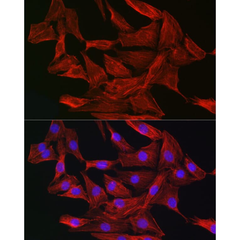 Immunofluorescence - Anti-Gelsolin Antibody (A93230) - Antibodies.com