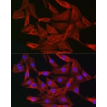 Immunofluorescence - Anti-Gelsolin Antibody (A93230) - Antibodies.com
