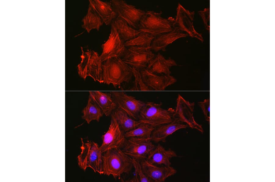 Immunofluorescence - Anti-Gelsolin Antibody (A93230) - Antibodies.com