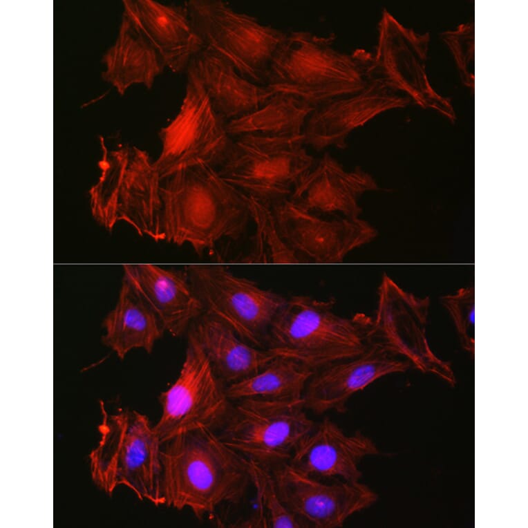 Immunofluorescence - Anti-Gelsolin Antibody (A93230) - Antibodies.com