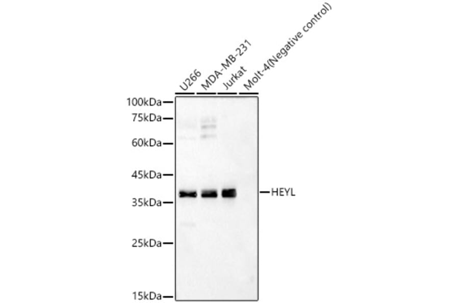 Western Blot - Anti-Hey L Antibody (A93235) - Antibodies.com