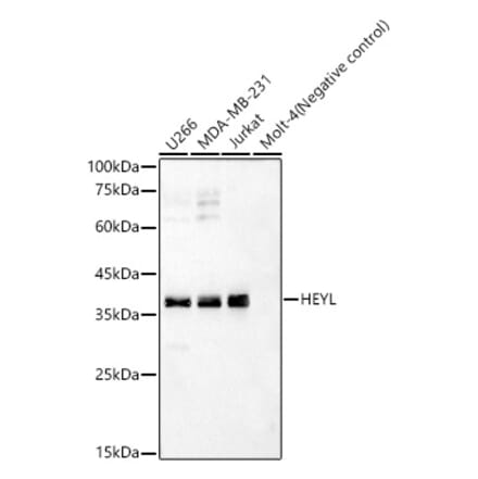 Western Blot - Anti-Hey L Antibody (A93235) - Antibodies.com