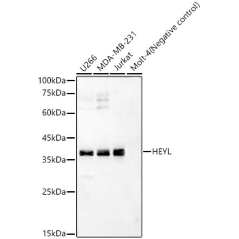 Western Blot - Anti-Hey L Antibody (A93235) - Antibodies.com