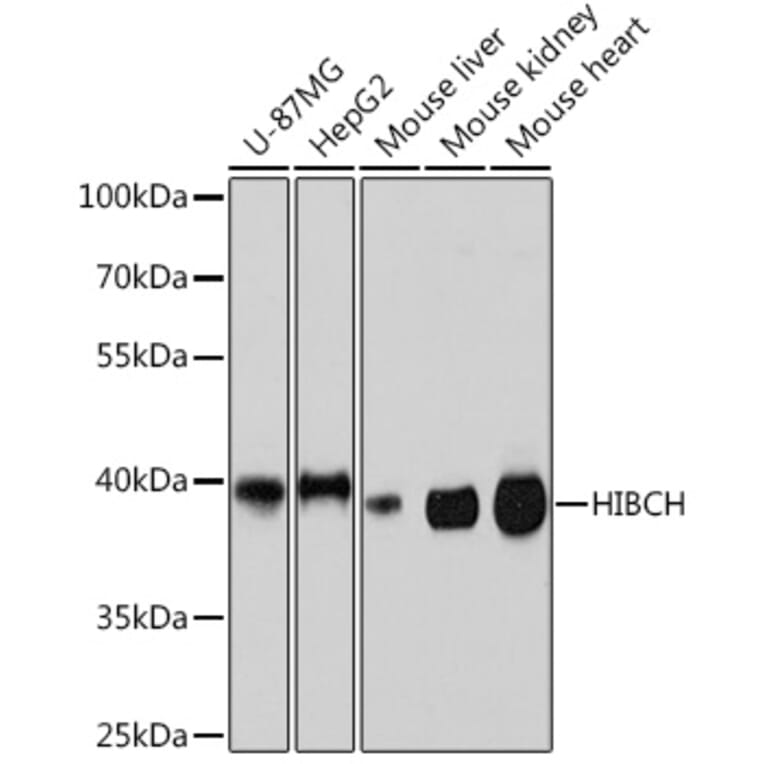 Western Blot - Anti-HIBCH Antibody (A93236) - Antibodies.com