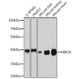 Western Blot - Anti-HIBCH Antibody (A93236) - Antibodies.com