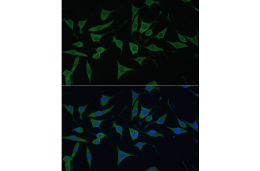 Immunofluorescence - Anti-HIBCH Antibody (A93236) - Antibodies.com