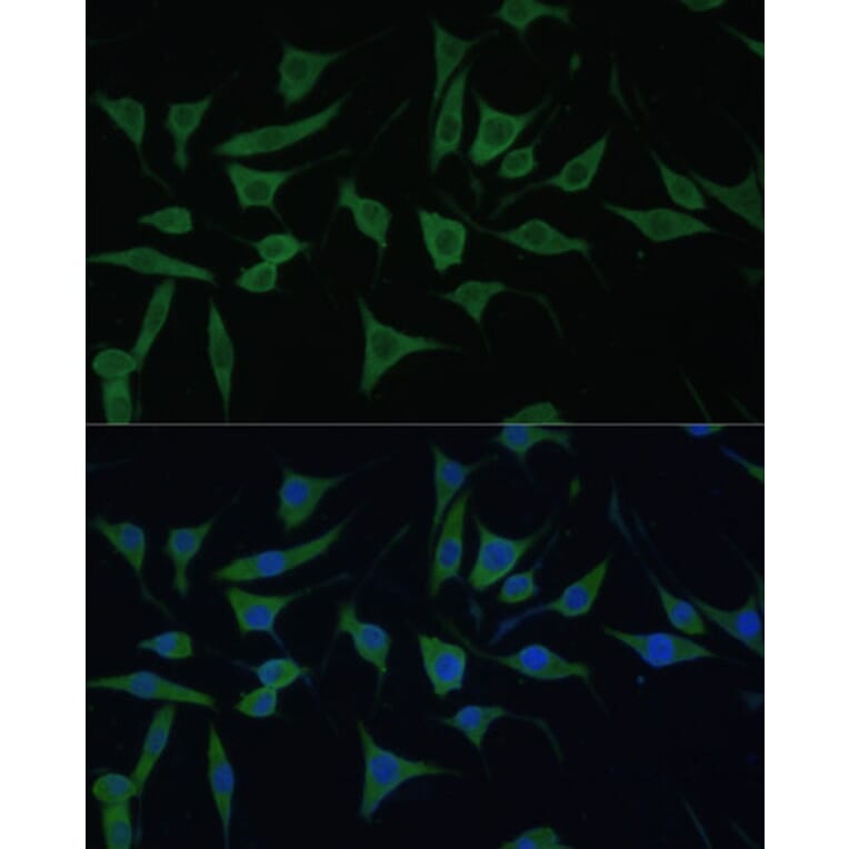 Immunofluorescence - Anti-HIBCH Antibody (A93236) - Antibodies.com