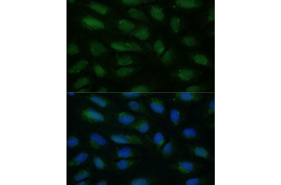Immunofluorescence - Anti-HIBCH Antibody (A93236) - Antibodies.com