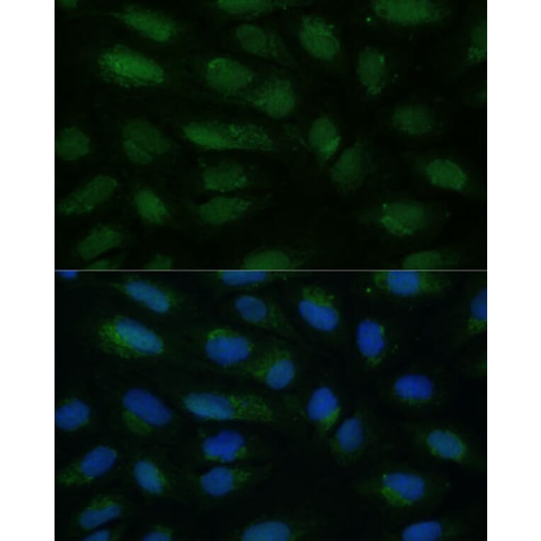 Immunofluorescence - Anti-HIBCH Antibody (A93236) - Antibodies.com