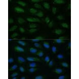 Immunofluorescence - Anti-HIBCH Antibody (A93236) - Antibodies.com