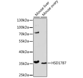 Western Blot - Anti-HSD17B7 Antibody (A93238) - Antibodies.com