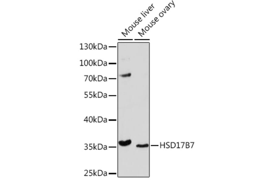 Western Blot - Anti-HSD17B7 Antibody (A93238) - Antibodies.com
