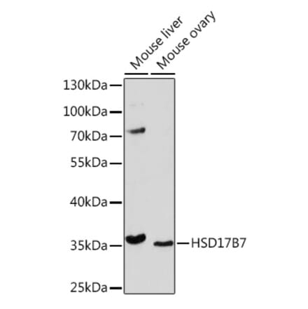 Western Blot - Anti-HSD17B7 Antibody (A93238) - Antibodies.com