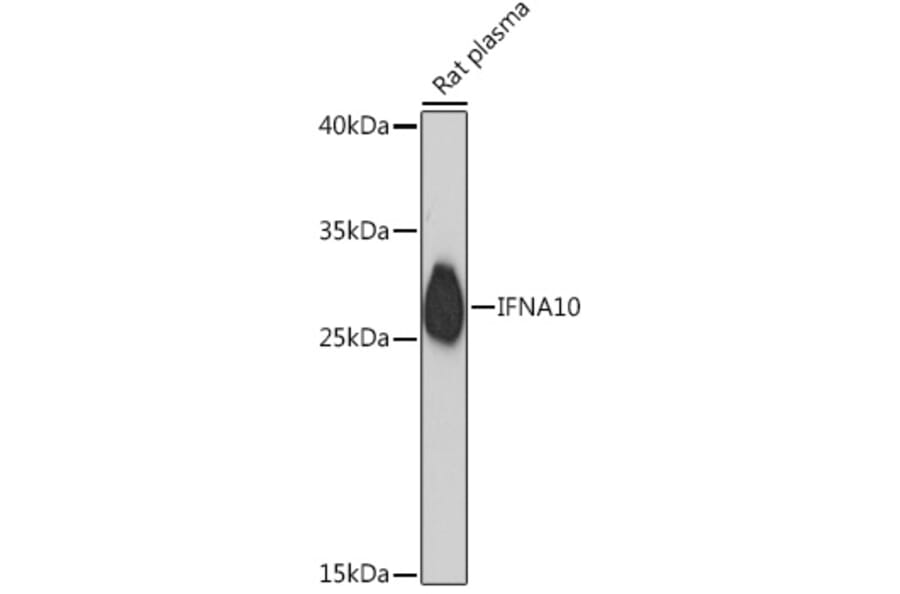 Western Blot - Anti-Interferon alpha 10 Antibody (A93240) - Antibodies.com