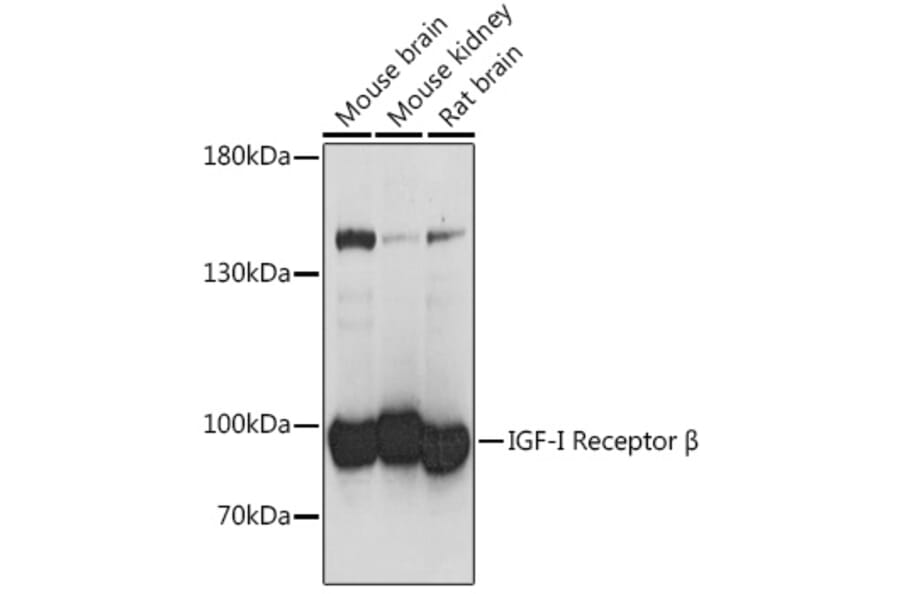 Western Blot - Anti-IGF1 Receptor Antibody (A93242) - Antibodies.com