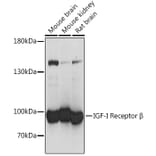 Western Blot - Anti-IGF1 Receptor Antibody (A93242) - Antibodies.com