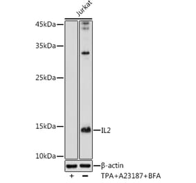 Western Blot - Anti-IL-2 Antibody (A93243) - Antibodies.com