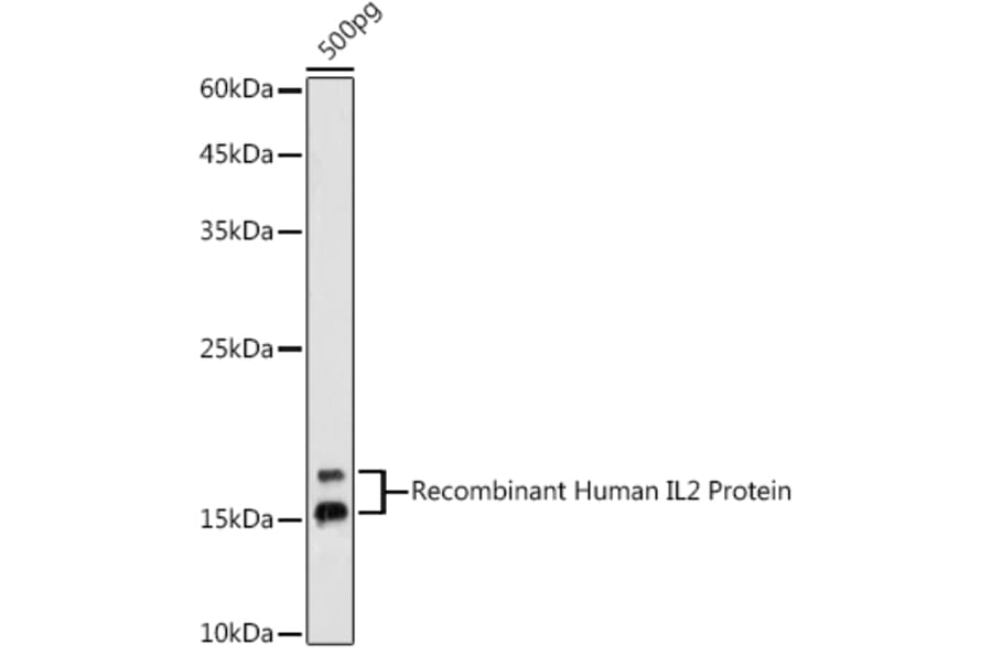 Western Blot - Anti-IL-2 Antibody (A93243) - Antibodies.com