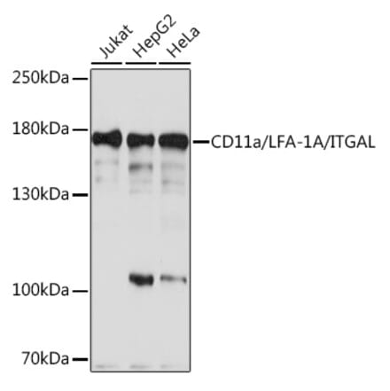 Western Blot - Anti-CD11a Antibody (A93245) - Antibodies.com