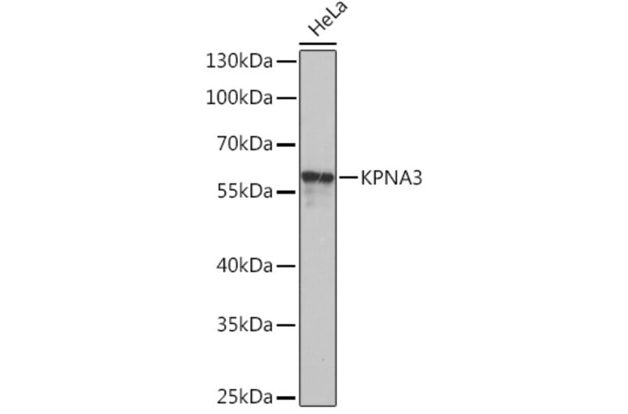 Western Blot - Anti-KPNA3 Antibody (A93248) - Antibodies.com