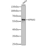 Western Blot - Anti-KPNA3 Antibody (A93248) - Antibodies.com