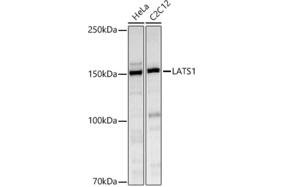 Western Blot - Anti-LATS1/WARTS Antibody (A93250) - Antibodies.com
