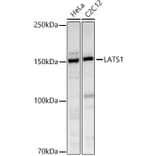 Western Blot - Anti-LATS1/WARTS Antibody (A93250) - Antibodies.com