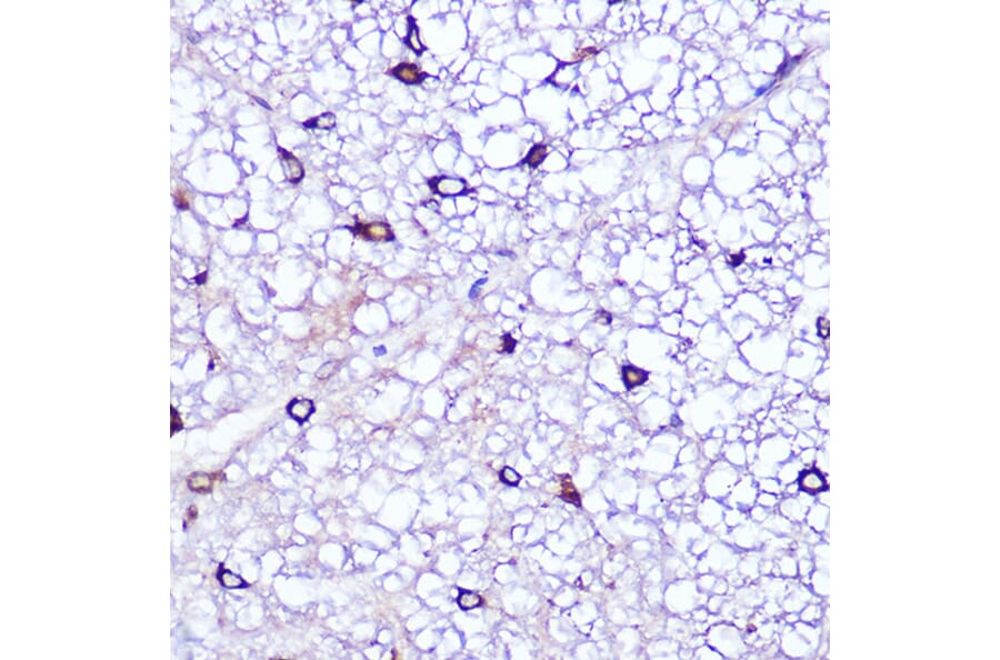 Immunohistochemistry - Anti-LATS1/WARTS Antibody (A93250) - Antibodies.com