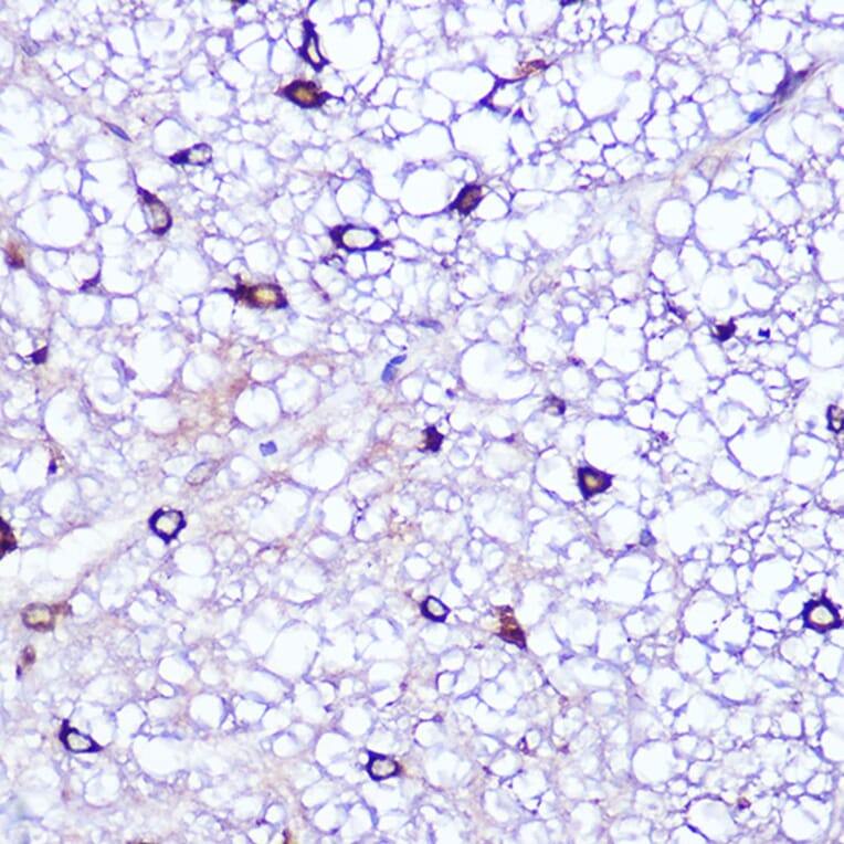 Immunohistochemistry - Anti-LATS1/WARTS Antibody (A93250) - Antibodies.com