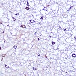 Immunohistochemistry - Anti-LATS1/WARTS Antibody (A93250) - Antibodies.com