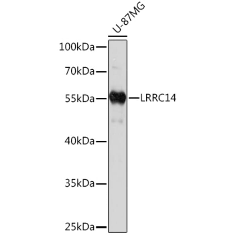 Western Blot - Anti-LRRC14 Antibody (A93253) - Antibodies.com