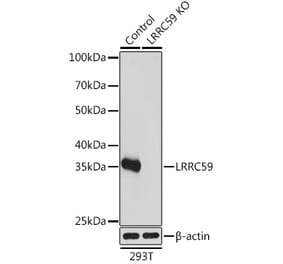 Western Blot - Anti-LRRC59 Antibody (A93255) - Antibodies.com