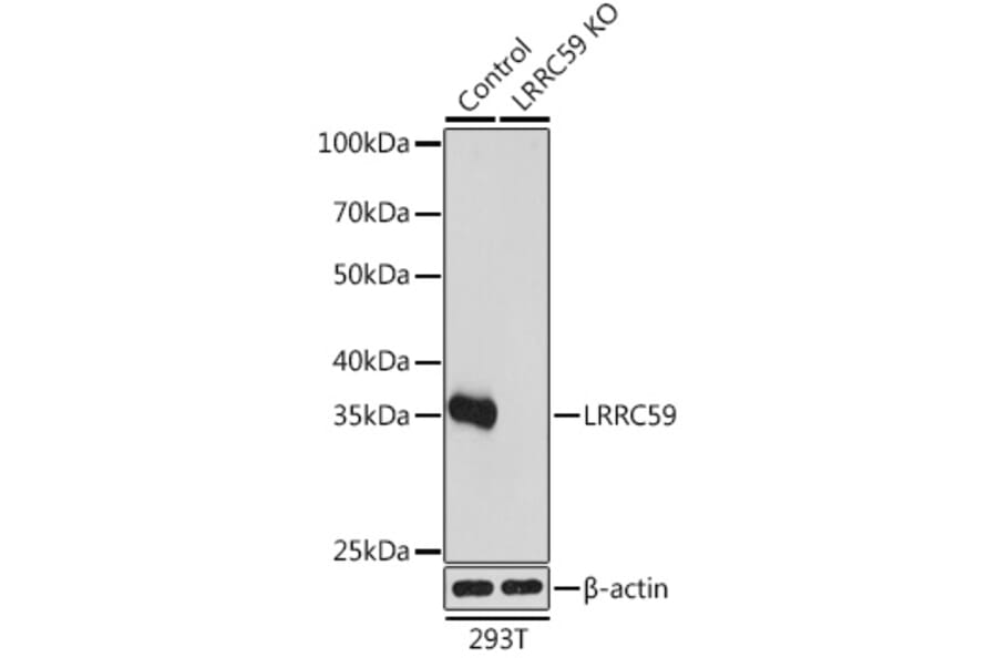 Western Blot - Anti-LRRC59 Antibody (A93255) - Antibodies.com