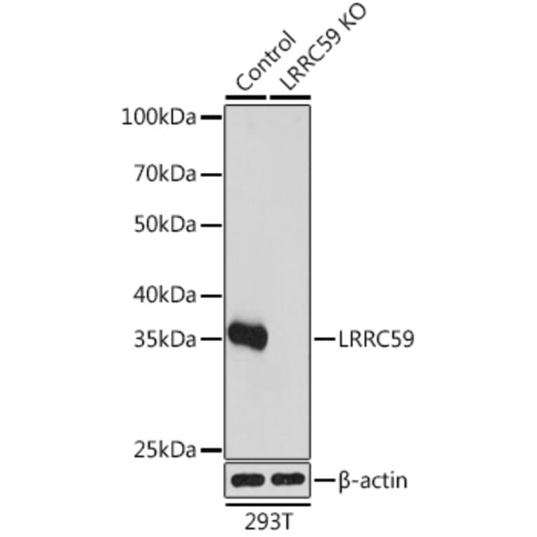 Western Blot - Anti-LRRC59 Antibody (A93255) - Antibodies.com