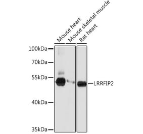 Western Blot - Anti-LRRFIP2 Antibody (A93256) - Antibodies.com