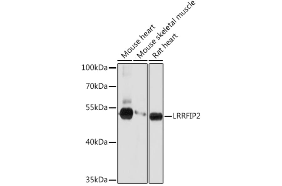 Western Blot - Anti-LRRFIP2 Antibody (A93256) - Antibodies.com
