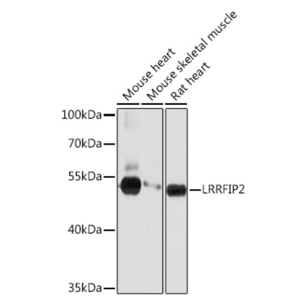 Western Blot - Anti-LRRFIP2 Antibody (A93256) - Antibodies.com